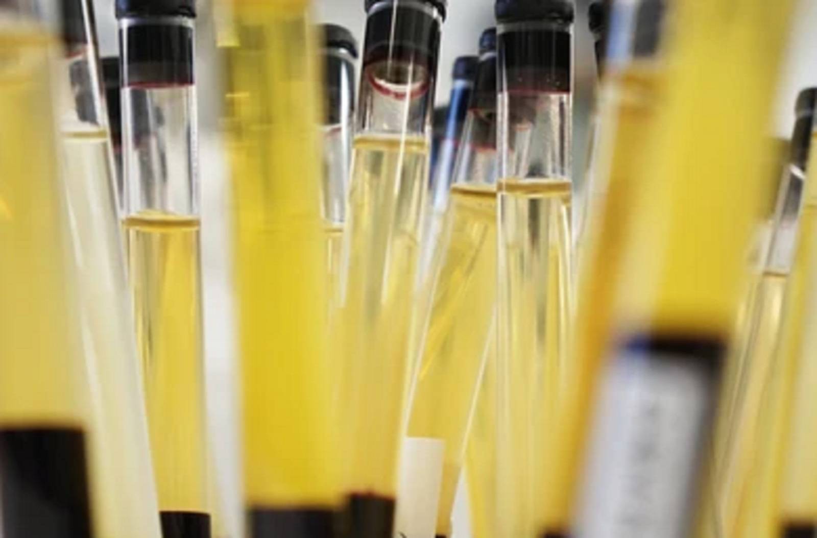 Vitesse de Sédimentation