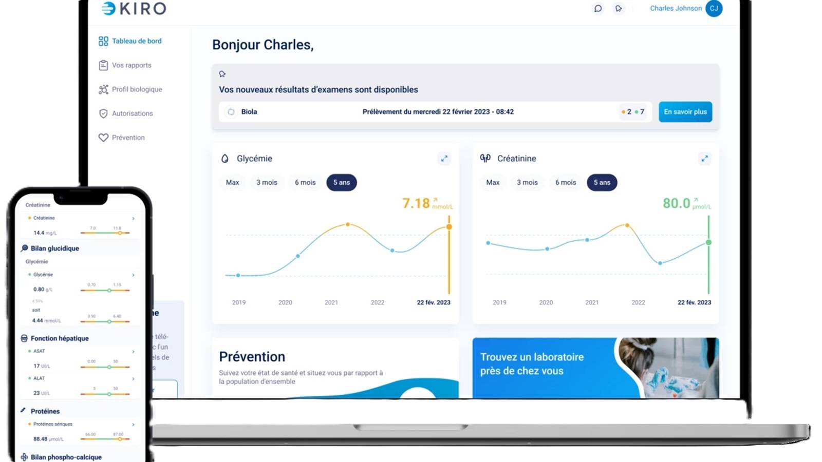 Kiro et Labio s’unissent pour une IA bienfaitrice