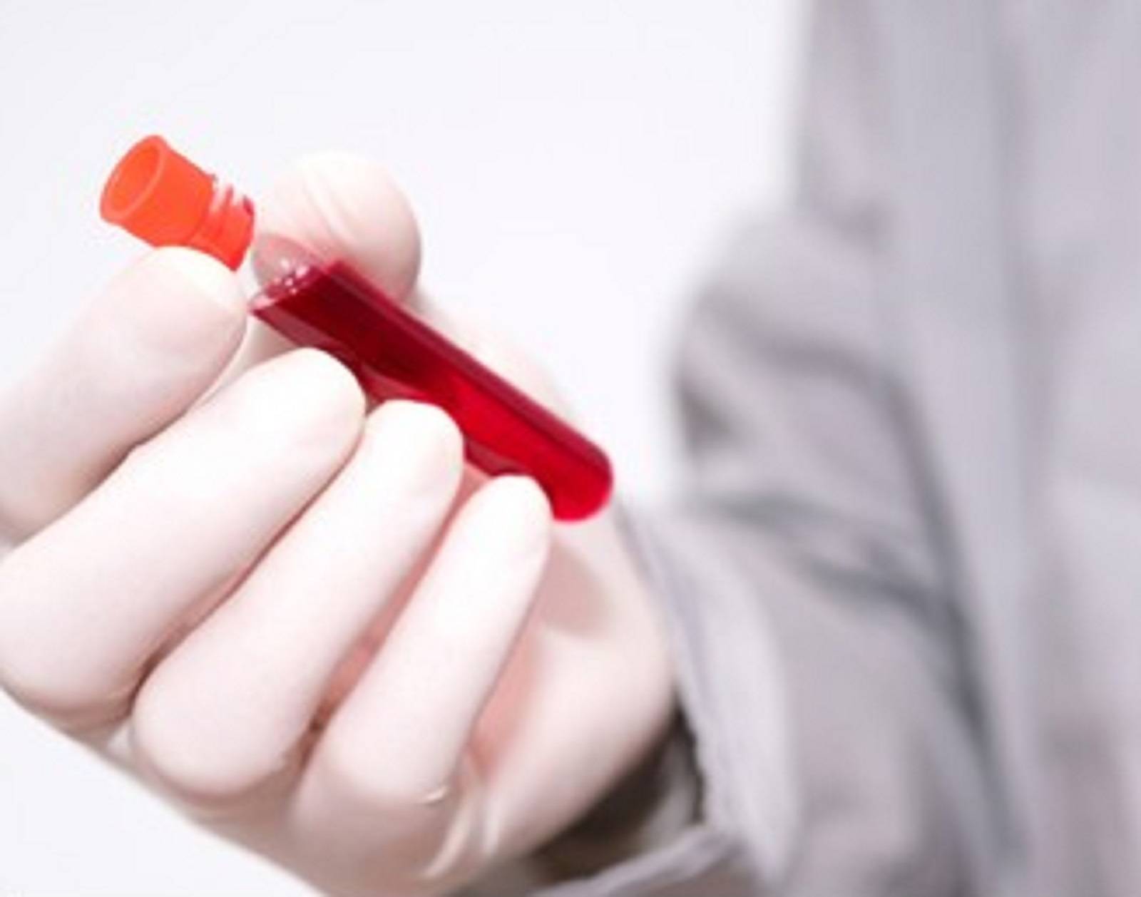 Bientôt des tests sanguins pour diagnostiquer la maladie d’Alzheimer